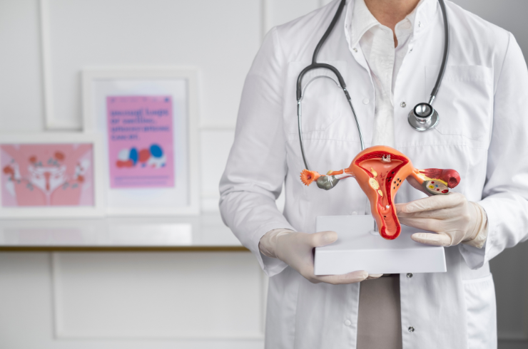 PCOS Management
